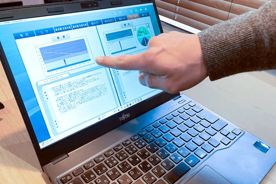 ノートパソコンに表示された肌分析データ